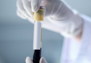 Какие анализы нужно сдать при подозрении на наличие в организме паразитов?