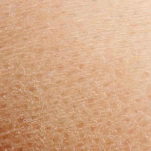 Сухая кожа у новорожденного Сухая кожа у ребенка: как действовать?