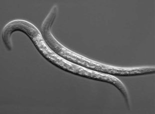 Какие существуют симптомы и каково лечение анизакидоза?