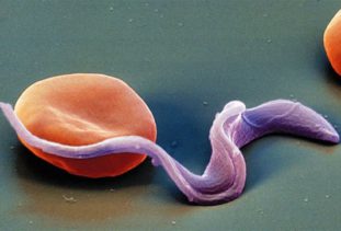 Токсоплазма