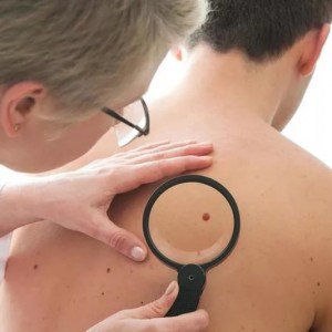 Диагностика Опасные родимые пятна на теле человека