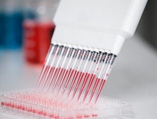 Как правильно расшифровывать ИФА (иммуноферментный анализ крови)?