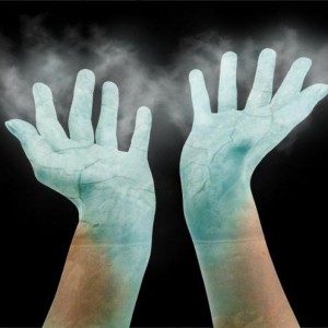 Аллергия на руках на холод Симптомы холодового дерматита и его отличительные признаки