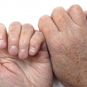 Почему облазит кожа на руках Облазит кожа рук: причины и что делать?