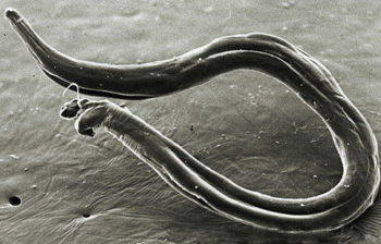 Фото: анкилостома