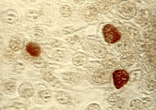 Хламидии трахоматис