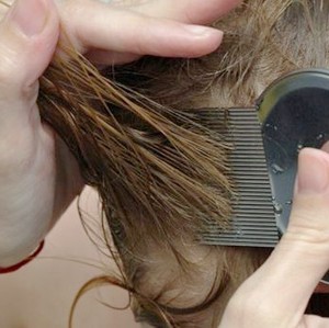 Механические средства от педикулеза Лечение педикулеза в домашних условиях
