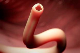 Кишечный глист