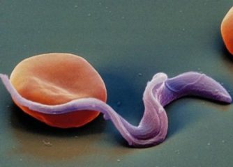 Токсоплазма