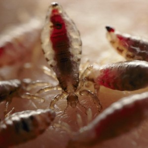 Вши Педикулез: диагностика, симптомы, лечение и фото